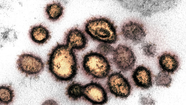 Hình ảnh trên kính hiển vi điện tử về SARS-CoV-2, virus gây bệnh COVID-19, được phân lập từ một bệnh nhân ở Mỹ. (Ảnh: Reuters)